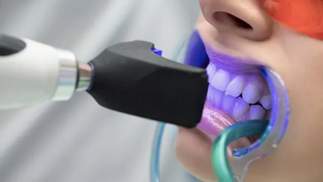 clareamento-laser-nobre-odontologia-1920w